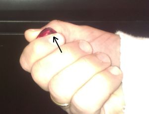 2014-01-11c standard pick grip w arrow showing pain point - viewed from below