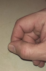 2014-01-14b How the pick squeezes the nailbed (without pick)